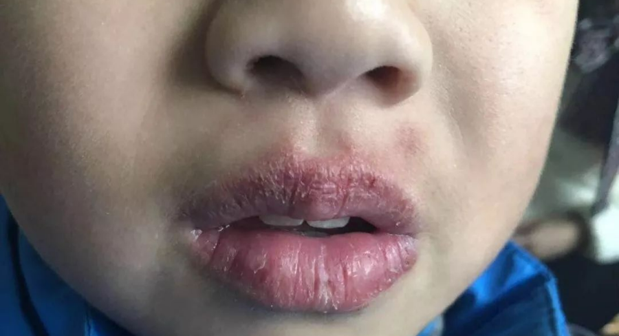 孕妈助孕服务生的婴儿吸嘴唇怎么回事，孕妈助孕服务生的婴儿吸嘴皮怎么回事