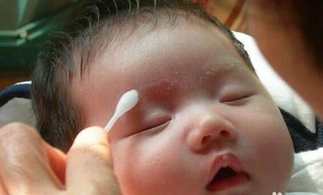孕妈助孕服务生的婴儿长湿疹是什么样子（孕妈助孕服务生的婴儿湿疹是什么样子的照片）